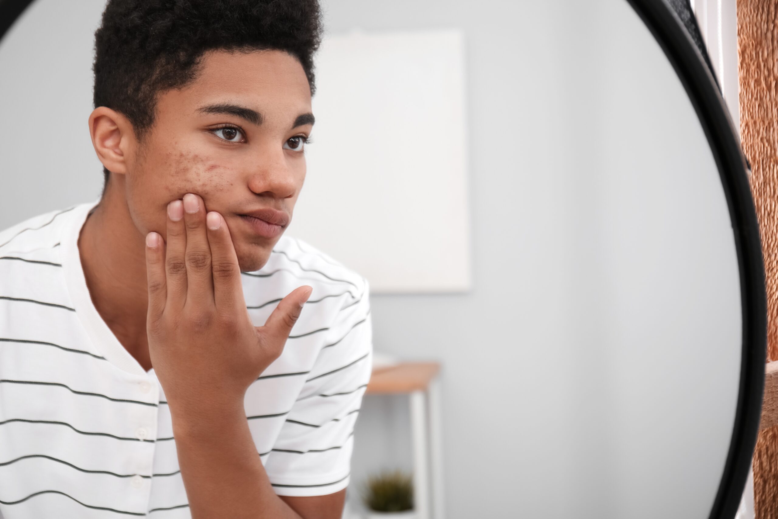 Trattamento contro acne Centro Medico Europa Firenze